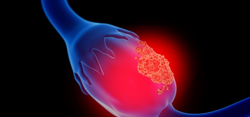 Trials of Lamassu Biotech's Cancer Treatment Protocol Gets Approval